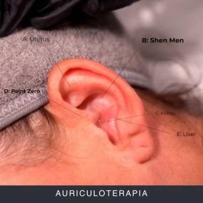 Auriculoterapia Curs Online