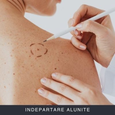 Indepartare alunite Curs Online