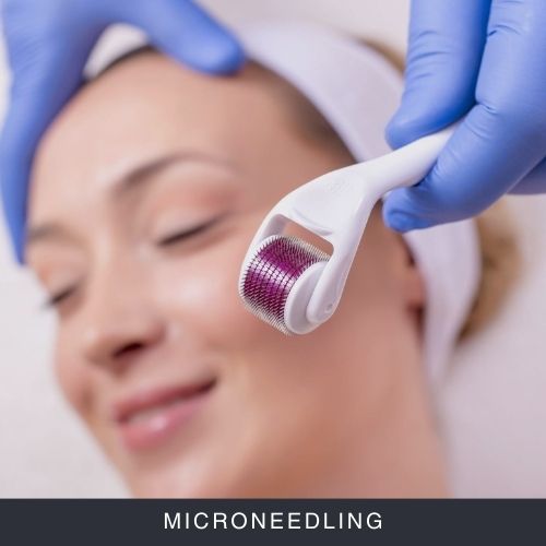 Microneedling Curs Online