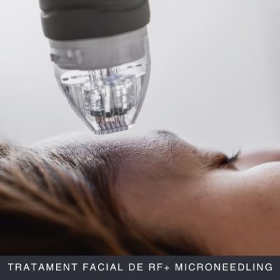 Tratament Facial de Radio Frecventa si Microneedling Curs Online