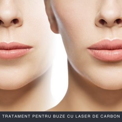 Tratament pentru Buze cu Laser de Carbon Curs Online