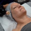 Curs de Tratament Facial Oxybrasion Online
